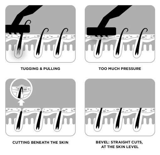 Prevent Razor Burn and Ingrown Hairs image 1